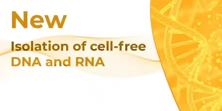 isolation-of-cell-free-dna-and-rna_12_1-14-1.webp isolation of cell free dna and rna 12 1 14 1.webp
